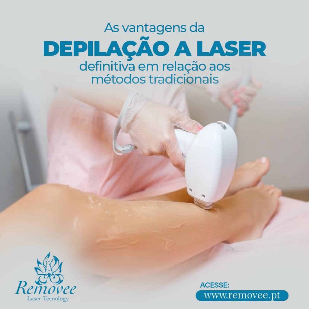 depilação laser